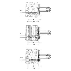 Keuco Befestigungs-Set Nr.1 Plan Care 34990000100 3 Holzschrauben und 3 Universalduebel
